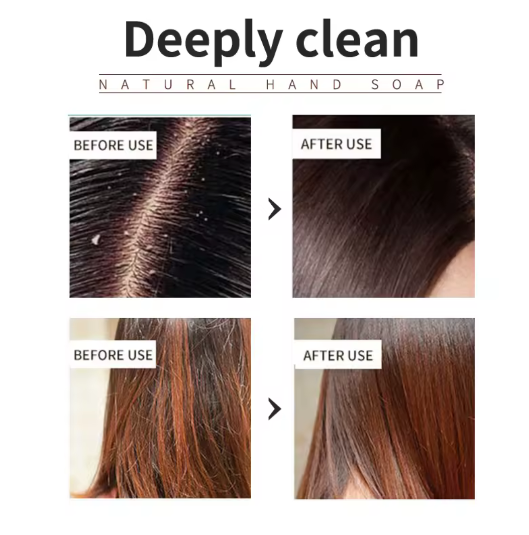 Shampooing Solide à l’Arbre à Thé – Pureté & Fraîcheur du Cuir Chevelu